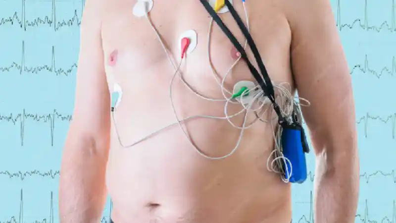 supraventricular tachycardia treatment