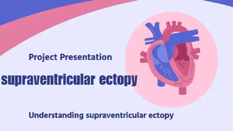 supraventricular ectopy
