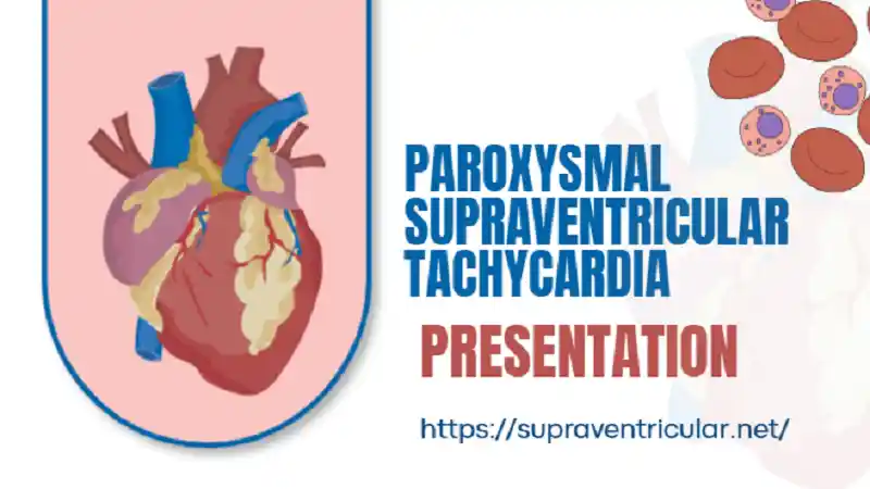 Paroxysmal Supraventricular Tachycardia