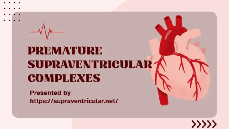 Understanding Premature Supraventricular Complexes