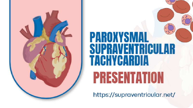 Paroxysmal Supraventricular Tachycardia