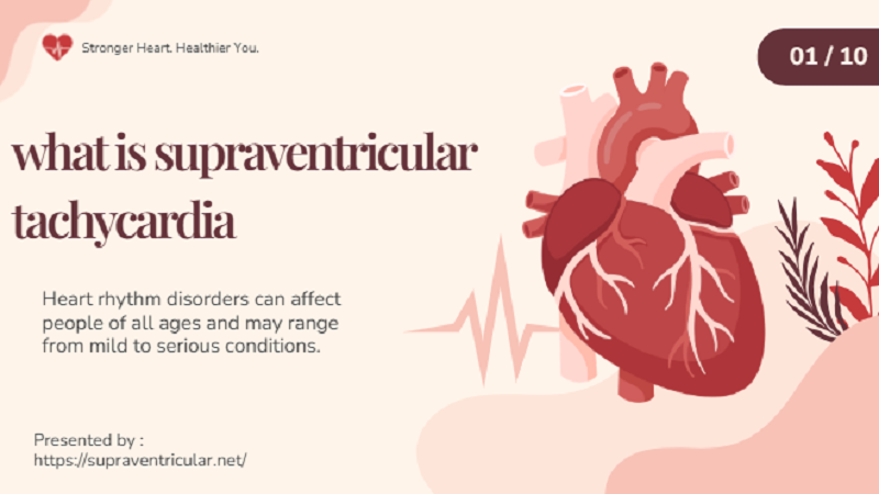 What Is Supraventricular Tachycardia?