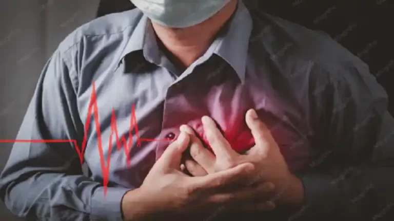 paroxysmal supraventricular tachycardia