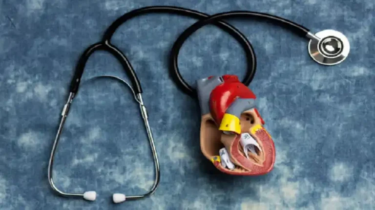 supraventricular tachycardia icd 10