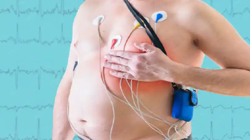 Paroxysmal Supraventricular Tachycardia