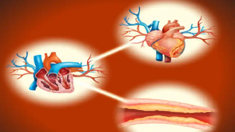 Supraventricular Ectopy